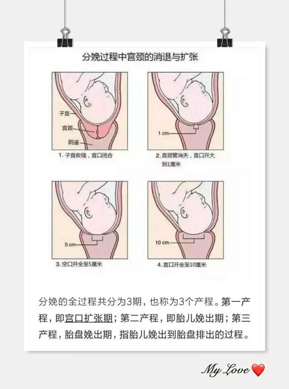 生产宝宝宫口开十指真的太痛苦了,每个妈妈都是特别,.