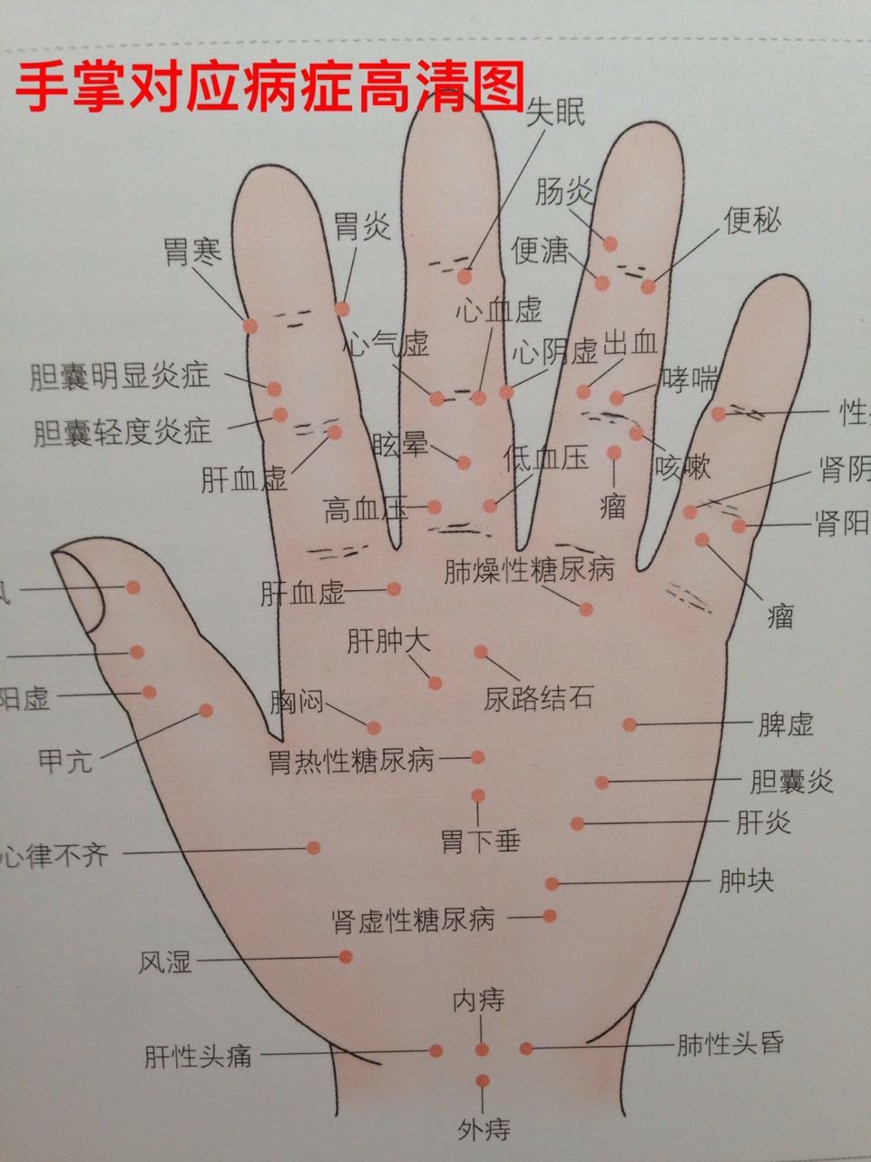 手掌对应病症高清图 - 观手知健康与健康养生的快手