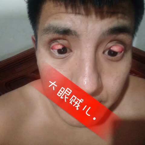 全网翻眼皮第一人