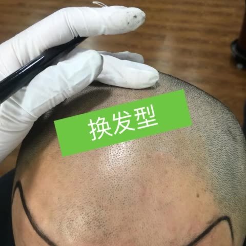 纹发价格是多少_纹发贵吗_一般纹发价格多少